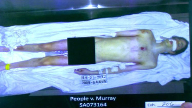Another Suspected Michael Jackson Autopsy Photo Leaked As He's Seen Naked